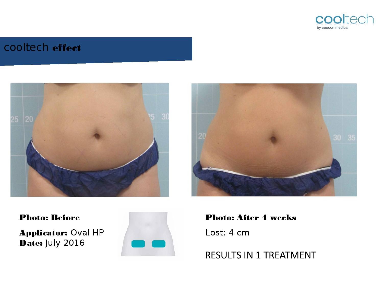 Presentation Cooltech ENG Wigmore Days Novaaaa1-page-006